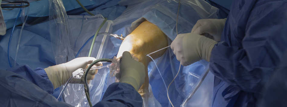 Knieprothese: Weer een normaal leven! Ervaringen van patiënten op website RPA Janssen, kniespecialist Eindhoven.